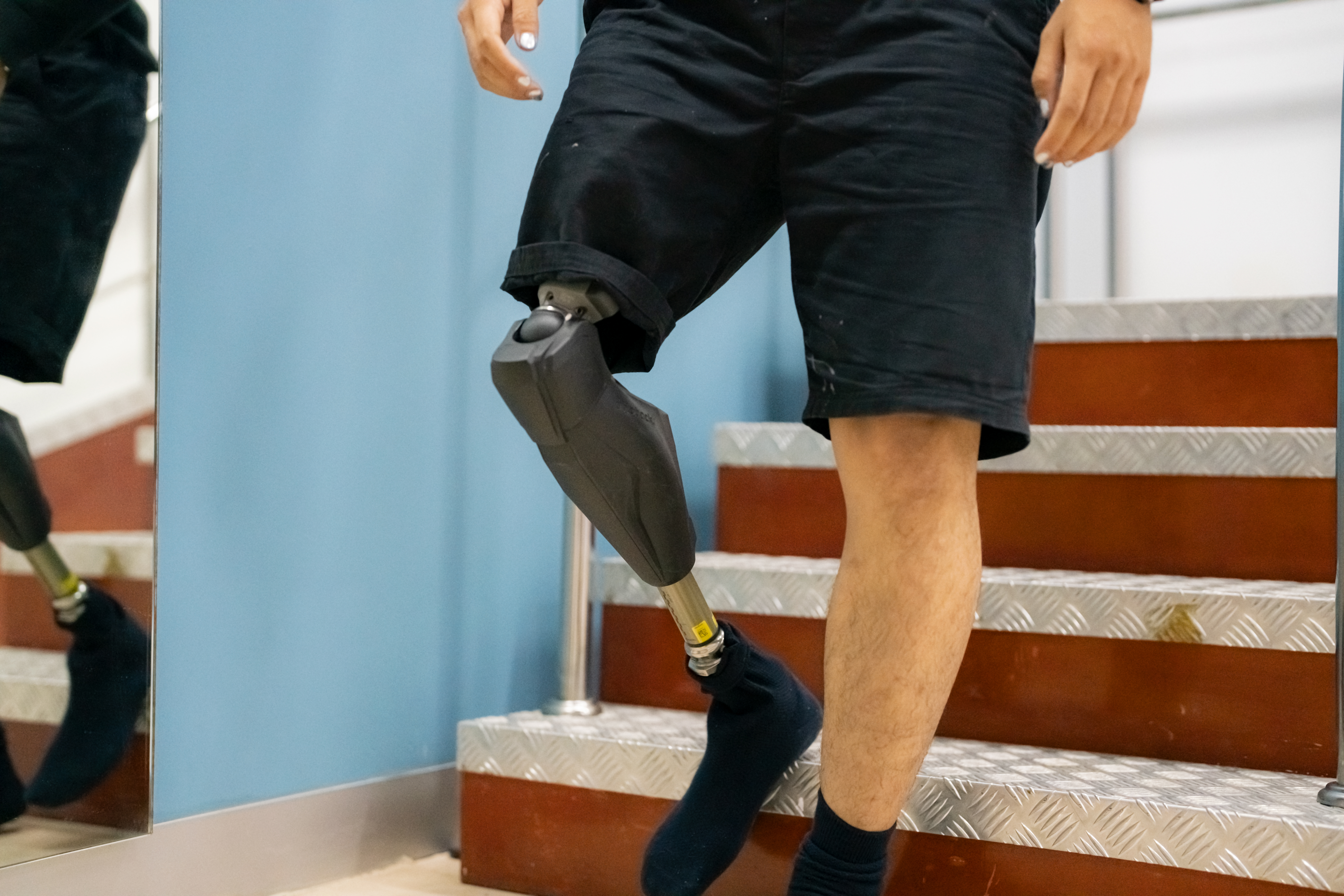 Unrecognizable disabilities on prosthetic leg.